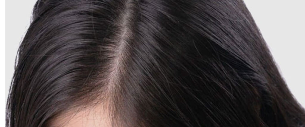 Understanding Hair Fall: Causes, Diet and Preventive Measures 1000024581 1024x427